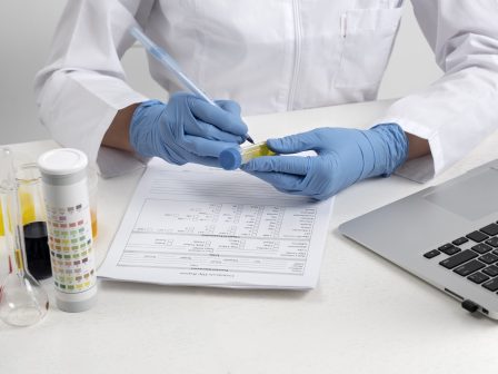 Diagnostika olejů a maziv - Fina Oleje